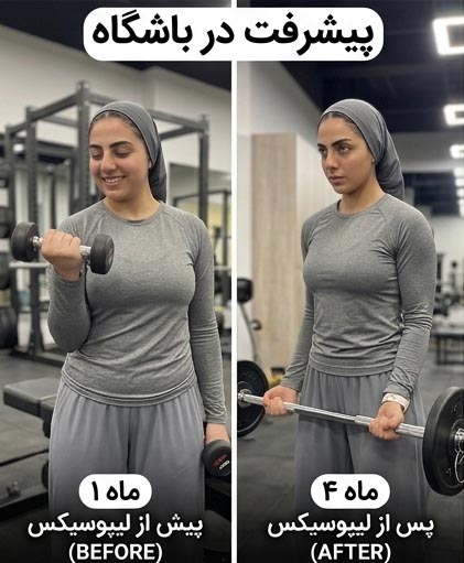 خرید لیپوسیکس